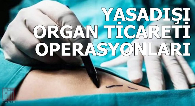 İstanbul'da yasadışı organ ticareti operasyonları