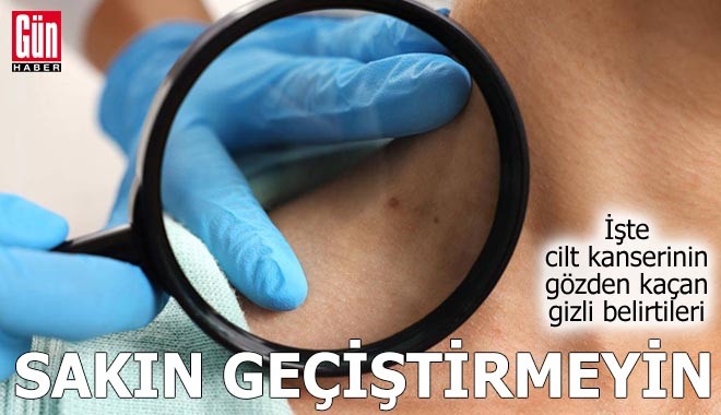 İşte cilt kanserinin gözden kaçan gizli belirtileri