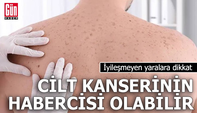 İyileşmeyen yaralara dikkat: Cilt kanserinin habercisi olabilir