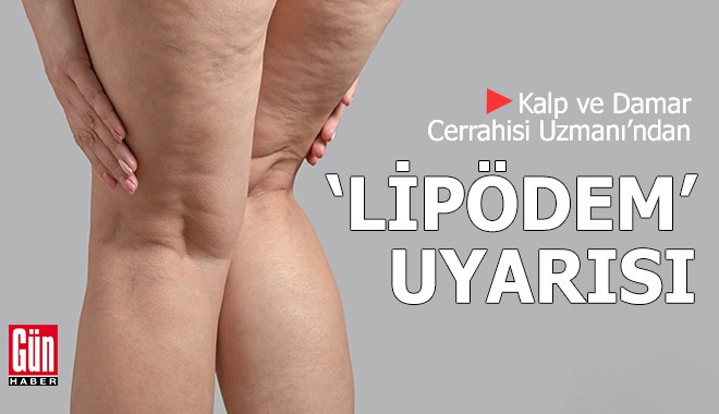 Kalp ve Damar Cerrahisi Uzmanı’ndan ‘lipödem’ uyarısı
