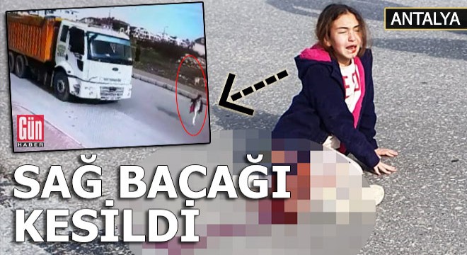 Kamyonun altında kalan Mahra'nın sağ bacağı kesildi