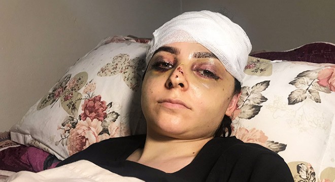 Karısını hastanelik etti, serbest kaldı