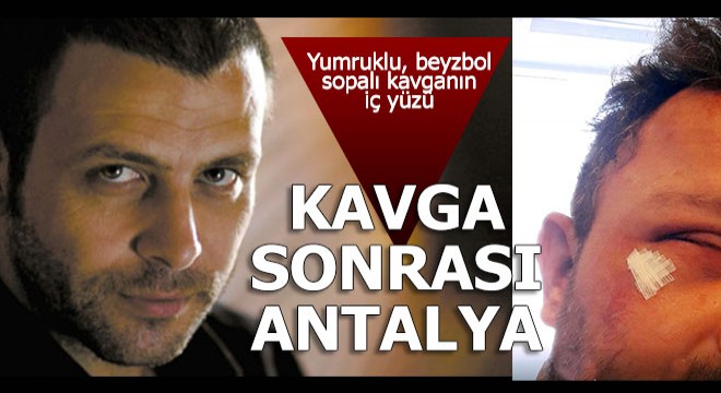 Kavga sonrası Antalya'ya geldi her şeyi anlattı