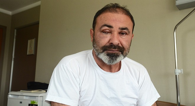 Kavgayı ayırırken gözünden oluyordu