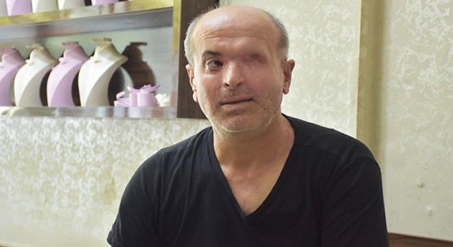 Kezzaplı saldırıya uğrayan kuyumcu, sol gözünü kaybetti