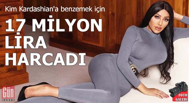 Kim Kardashian'a benzemek için 17 milyon lira harcadı!