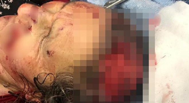 Kırşehir'de köpeklerin saldırdığı kadın ağır yaralandı