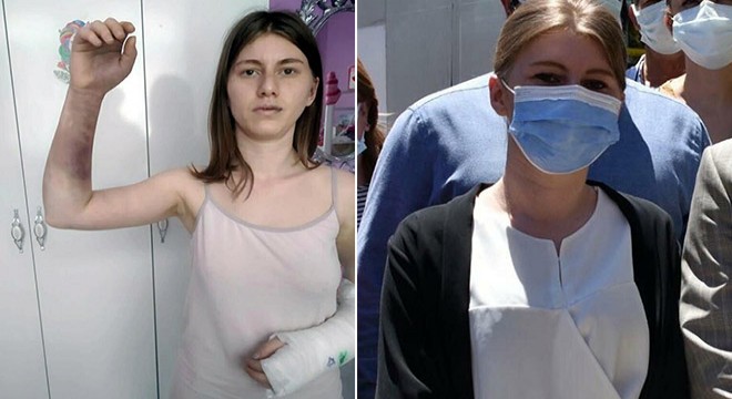 Kız arkadaşını beyzbol sopasıyla döven sanığa hapis