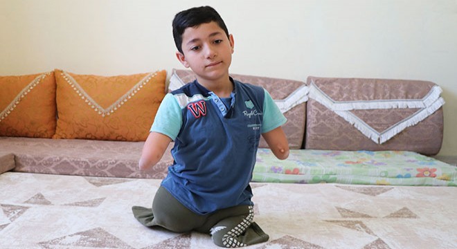 Kolları ve bacakları olmayan Nakşin, protez istiyor