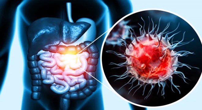 Kolon kanserine davetiye çıkaran o hata