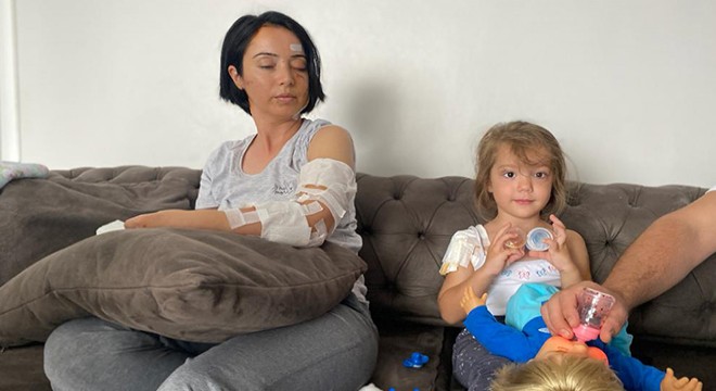 Köpek saldırısına uğrayan anne- kız yaralandı
