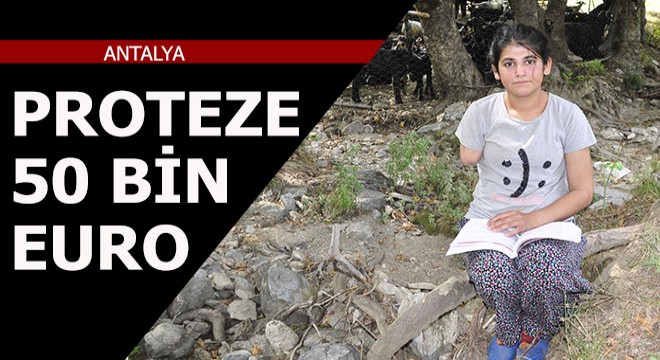 Köpekler kolunu parçaladı, yerine takılacak proteze 50 bin euro istendi