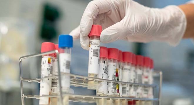 Koronavirüs tedavisi gördüğü hastaneden kaçtı, hayatını kaybetti