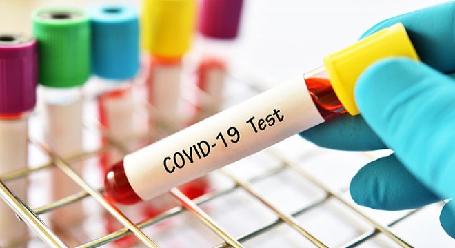Koronavirüs testi pozitif çıkan kadın, otobüste yakalandı