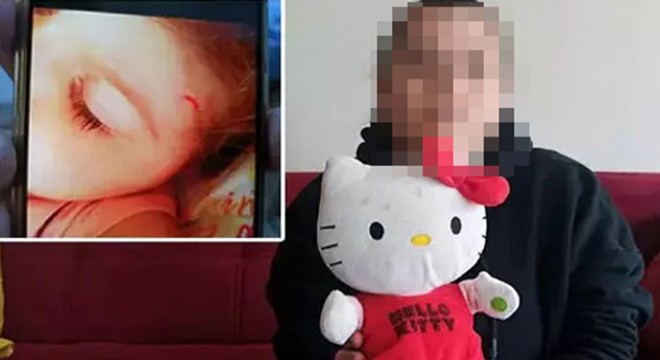 Kreşte şiddet olayında 4 yıl sonra dava