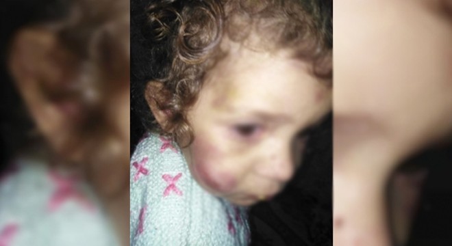 Küçük Firdevs'i darbeden anne tutuklandı