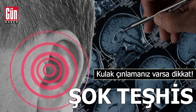 Kulak çınlamanız varsa dikkat!