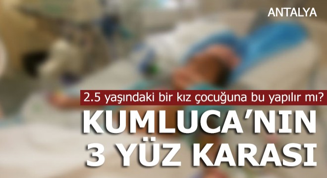 Kumluca'da 3 yüz karası