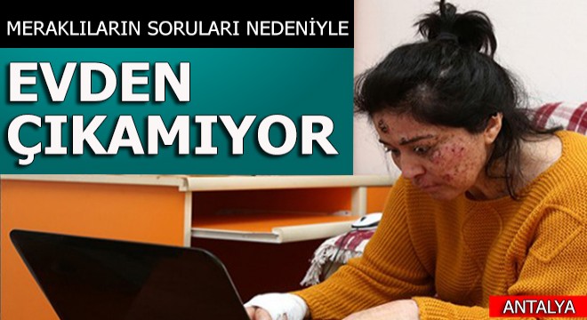 Meraklıların soruları nedeniyle evden çıkmıyor