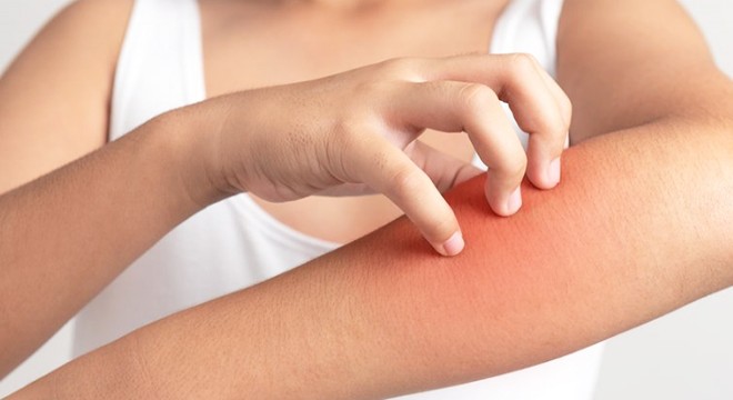 Merdiven altı güzellik salonlarında 'uyuz' hastalığına dikkat