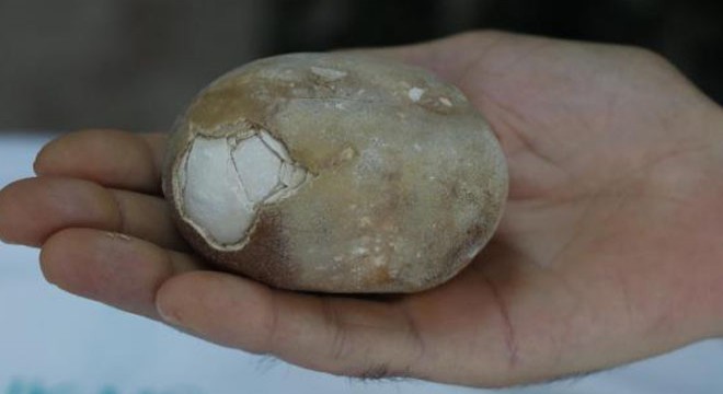 Mesanesinden 522 gramlık tek parça taş çıktı