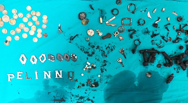 Midesinden 580 gram metal çıkarıldı