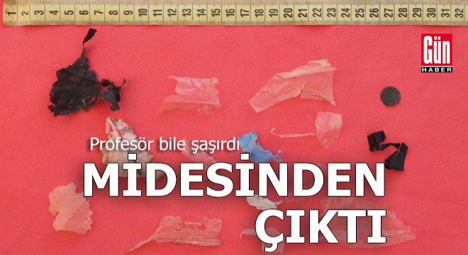Midesinden çıkanlar profesörü de şaşırttı