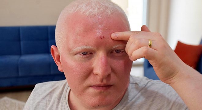 Midibüs şoföründen görme engelliye 'ücretsiz kart' dayağı