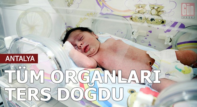 Muammer, tüm organları ters doğdu