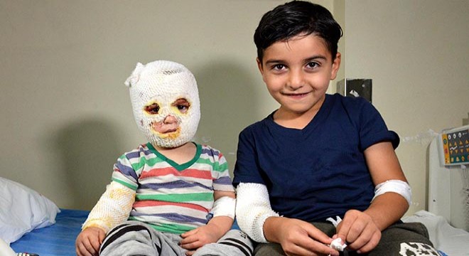 Ocaktaki çaydanlık 2 kardeşin üzerine devrildi