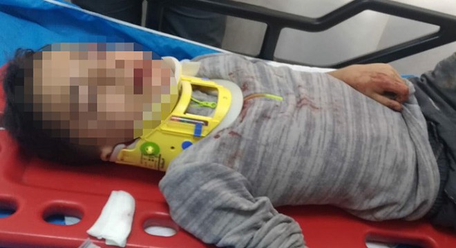 Okul bahçesinde oynarken mazgala düştü