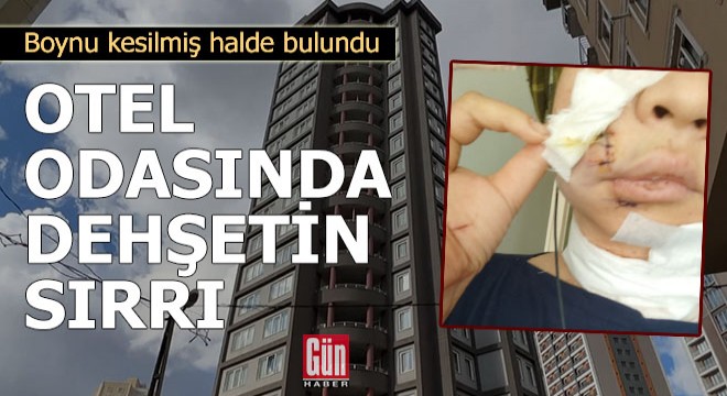 Otel odasında dehşetin sırrı