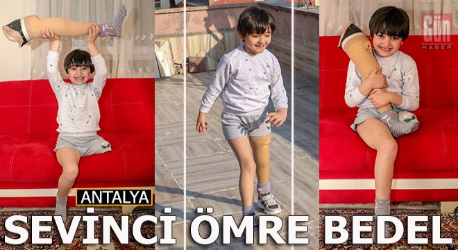Özge'nin yeni protez sevinci