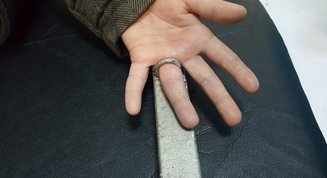 Parmağı demire sıkışan Onur'u itfaiye kurtardı
