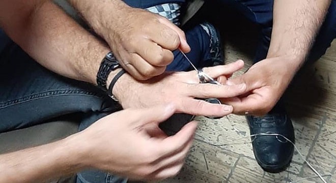 Parmağında sıkışan yüzüğü itfaiye çıkardı