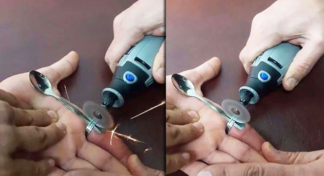 Parmağında sıkışan yüzük, ispiralle kesildi