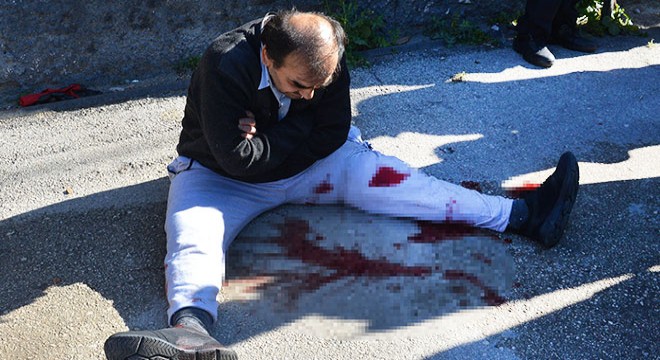 Polisi bıçakla yaralayan şizofreni hastası ayaklarından vuruldu
