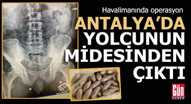 Polisten Antalya Havalimanı'nda yolcuya 'Mide' operasyonu
