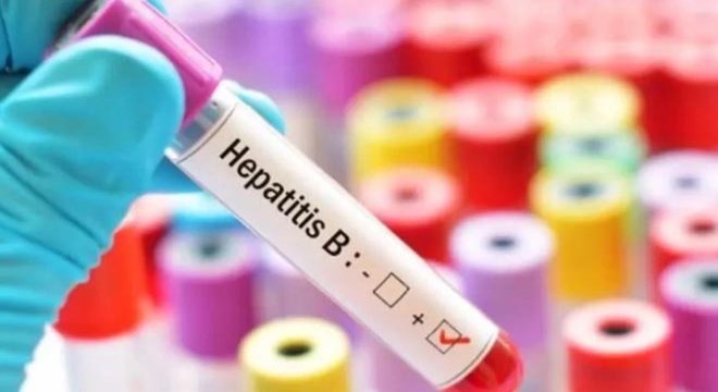 Sağlık Bakanlığı: Türkiye de hepatit görülme sıklığı azaldı