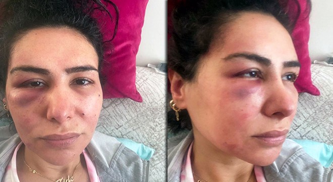 Şiddet uyguladığı kadın için 'Sevgiliydik' dedi, tutuklandı