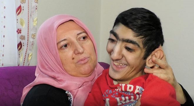 Skolyoz hastası Özkan, ameliyat olmayı bekliyor