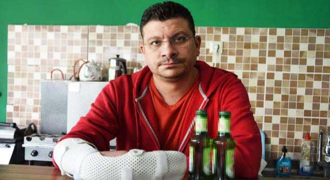 Soda şişelerini açmaya çalışırken elinde patladı