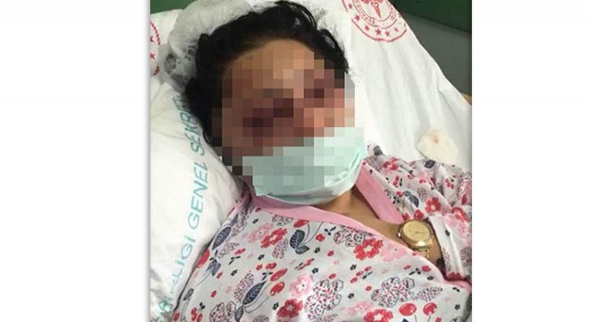 Sokak ortasında darp edilen kadının avukatları bildiri yayımladı
