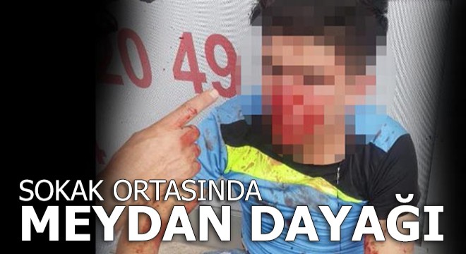 Sokak ortasında meydan dayağı