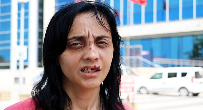 Sokakta tanımadığı kadına yumruk atıp, dişlerini kırdı
