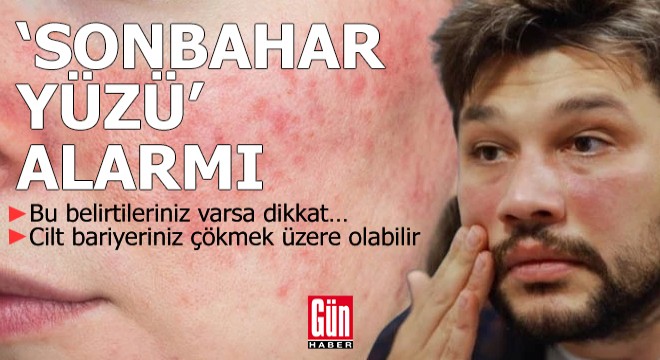 ‘Sonbahar yüzü’ alarmı! Bu belirtileriniz varsa dikkat