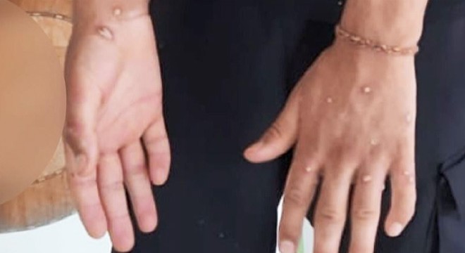 Sultangazi'de 'Maymun çiçeği ' hareketliliği