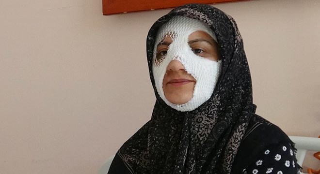 Suyun altına tuttuğu düdüklü tencere patladı, yüzü yandı