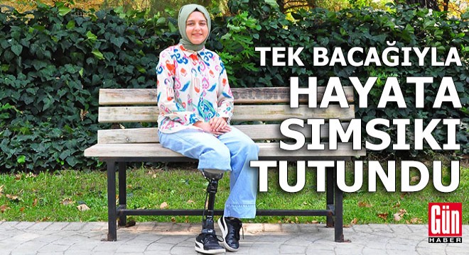 Tek bacağıyla hayata sıkı sıkıya tutundu