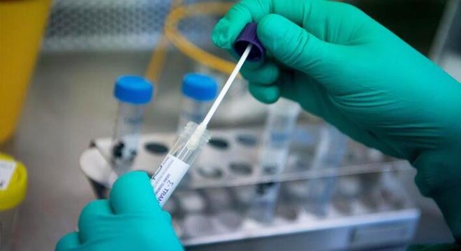 Temaslıları bildirmedi, savcılık soruşturma başlattı